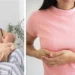 Penyakit Cracked Nipple, Berikut Gejala dan Cara Pencegahannya di 2024!